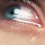 Suicidal.Dream