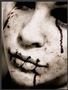 Peste-noire