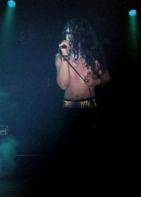 Anorexia Nervosa