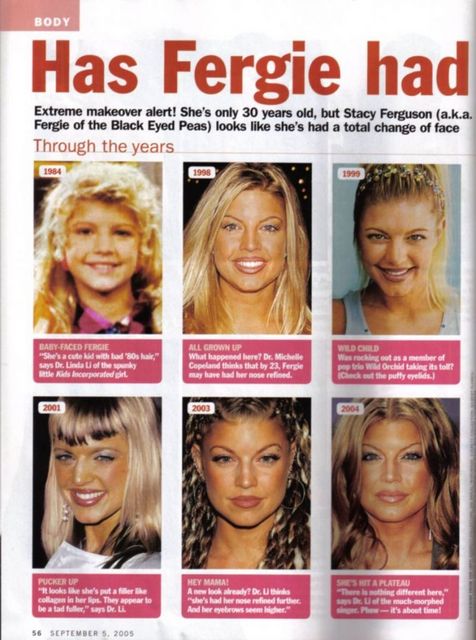 Fergie