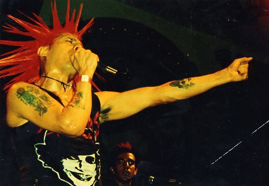 The Casualties