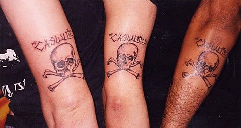 The Casualties