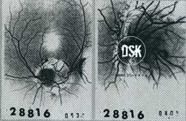 DSK
